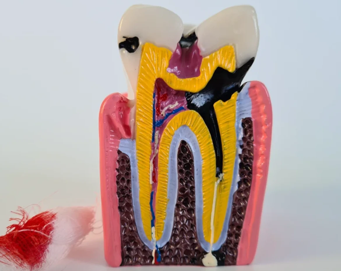endodonzia endodonzia e conservativa napoli